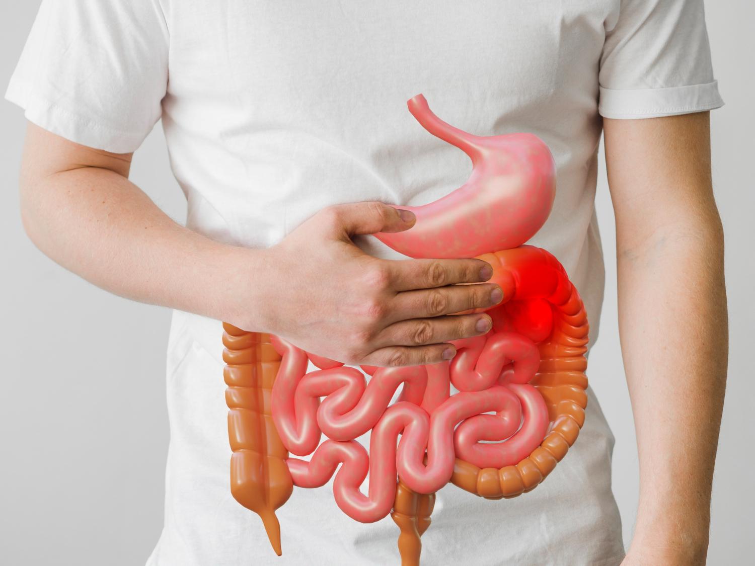 Unmasking Colon Cancer: Causes, Symptoms, and Strategies for Prevention